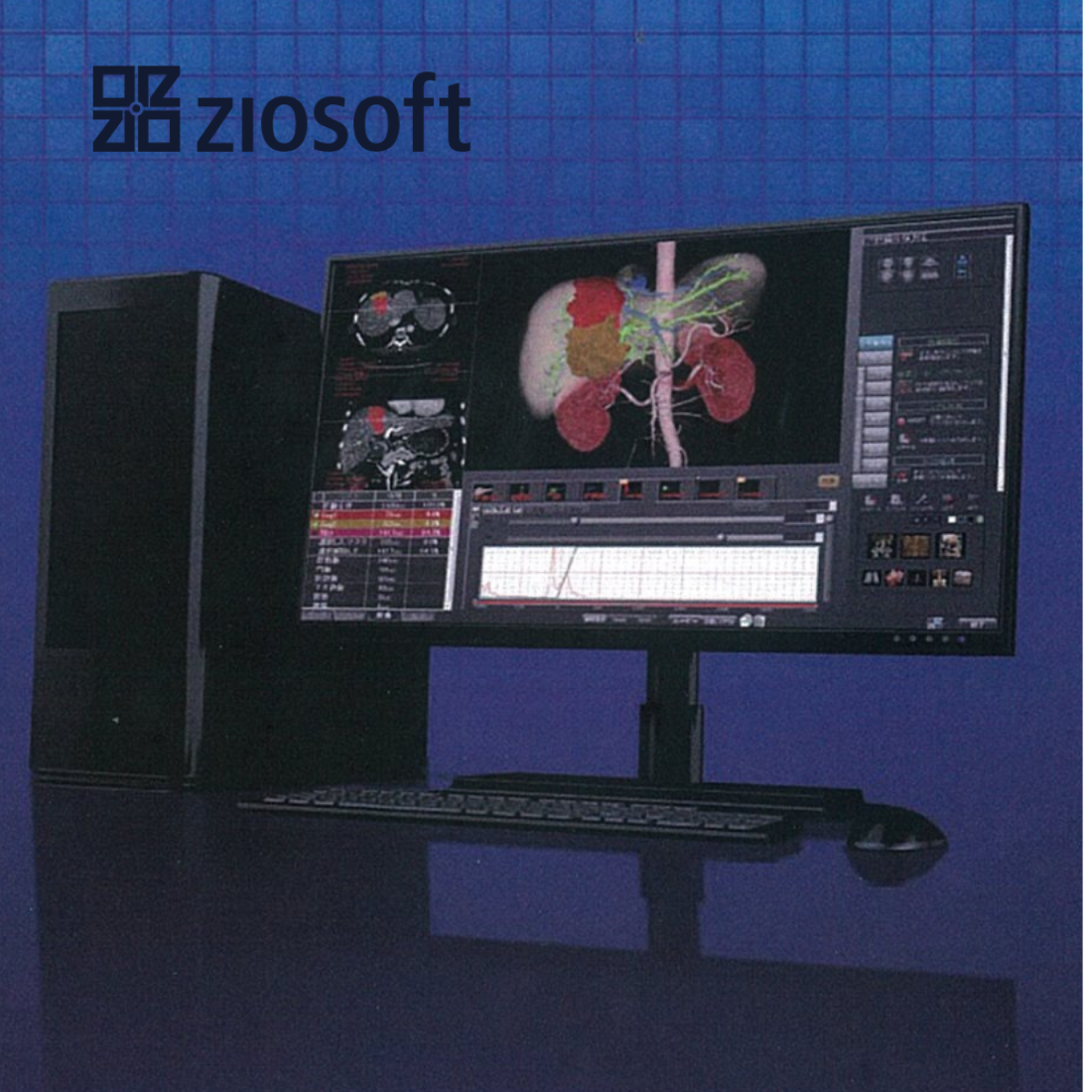 Trạm xử lý hình ảnh 3D, 4D Ziosoft Workstation