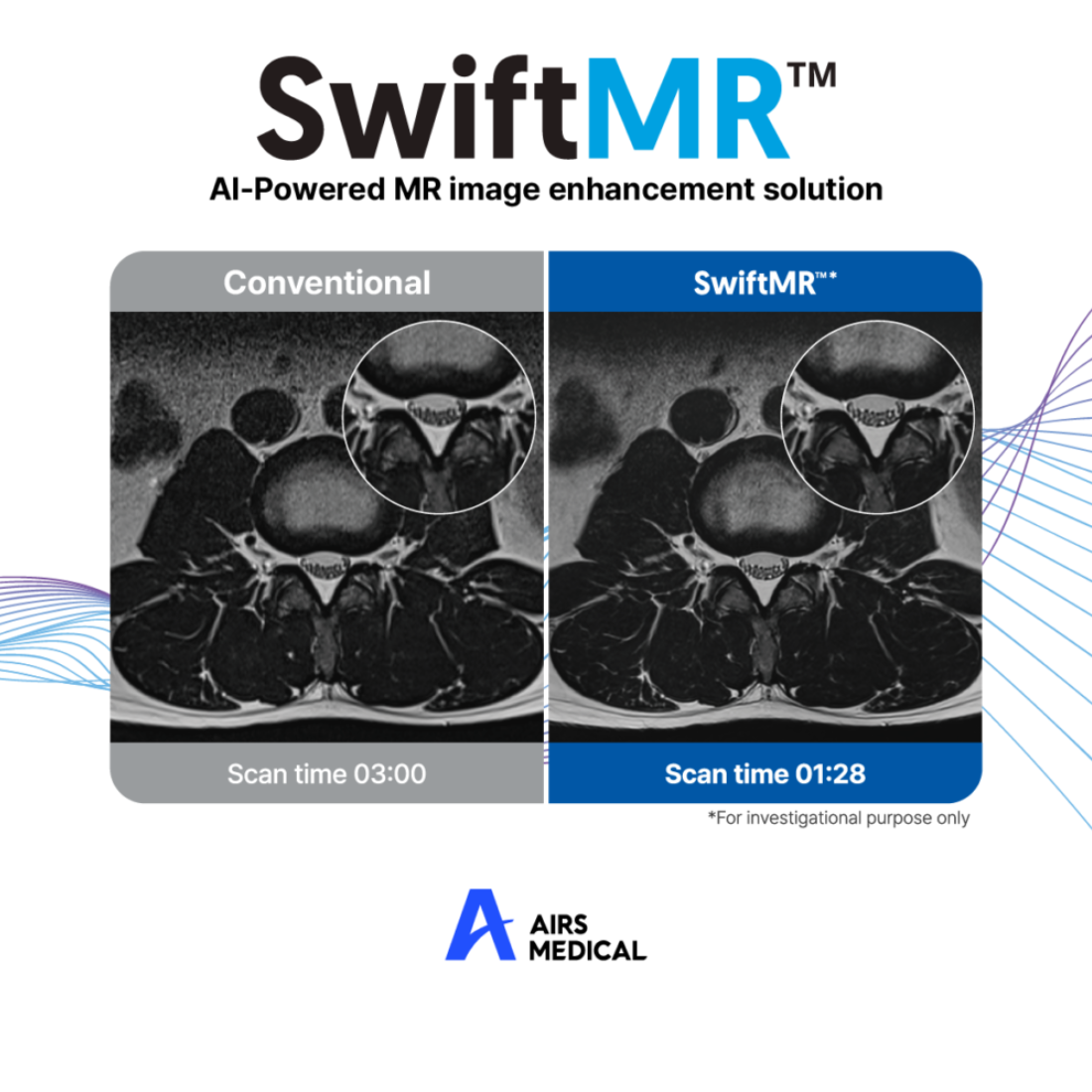 Giải pháp hình ảnh trong MRI - SwiftMR™