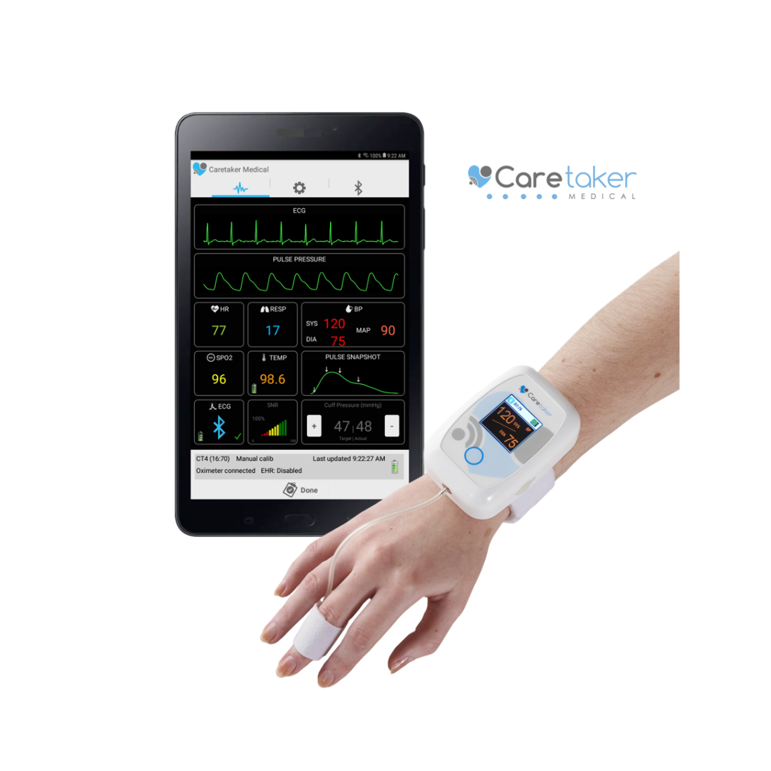 Holter huyết áp không dây công nghệ cNIBP